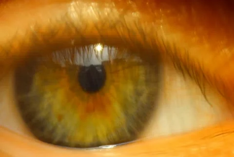 Eye Stock-Footage 11153169