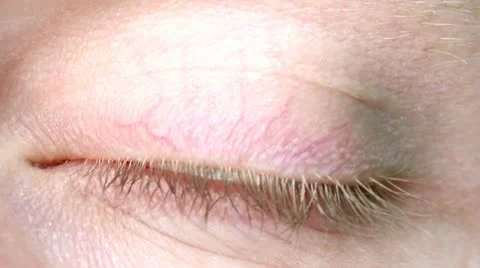 Eye Stock Footage 18194928