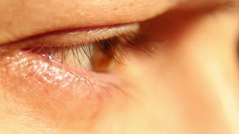 The Eye Video stock 79465779