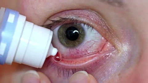 Eye Stock Footage 292783042