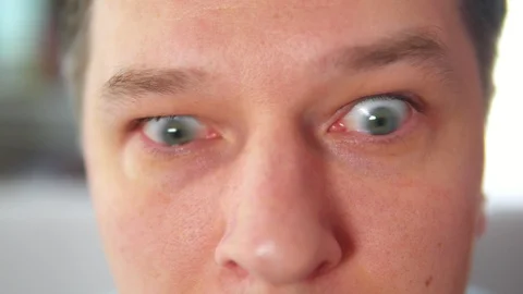 Eye movement. Eyes running from side to side Stock Footage 107849937