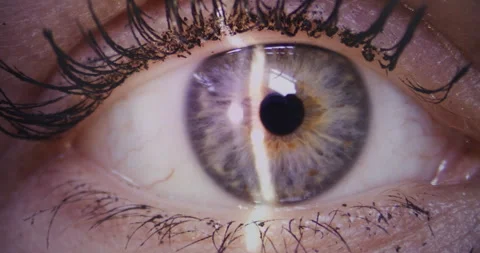 Eye Retina Examination Close-up Stock Footage 310802971