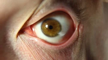 Eye Rotation Of The Eyeball. Close-up of man eye that blink, crazy looks around Stock Footage