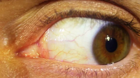 Eye Rotation Of The Eyeball Stock Footage 68557823