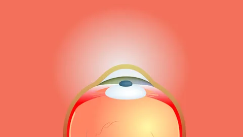 Eye sergery Stock Footage 236975266