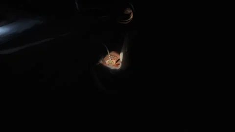 Eye surgery, shooting video from hands Vídeos de archivo 322617455