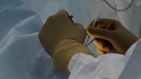 Eye surgery, shooting video from hands Vídeos de archivo 322619781