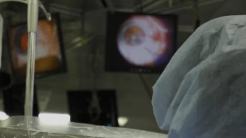 Eye surgery, shooting video from hands Stock-Footage 322622089