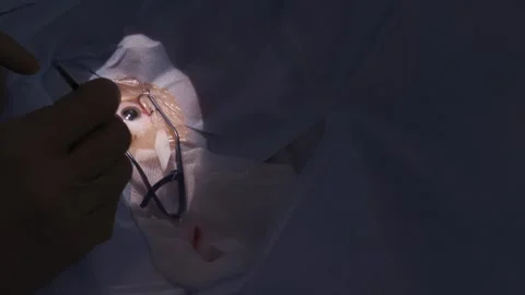 Eye surgery, shooting video from hands Stock-Footage 322626730