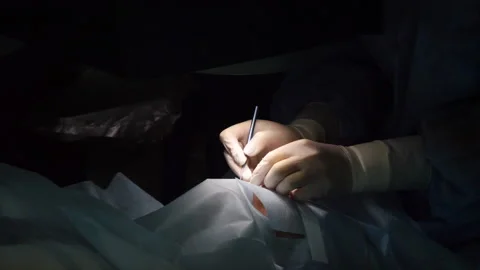 Eye surgery slo mo Stock Footage 140124499