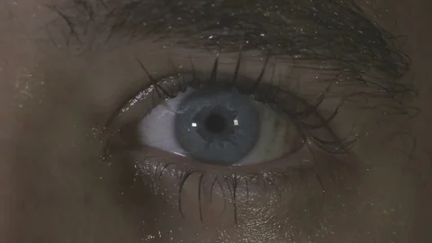 An eye twitches nervously Stock Footage 73109575