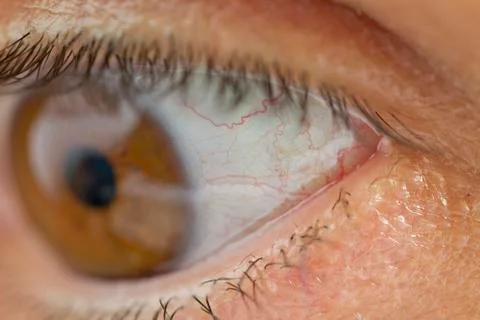 Eye veins Stock Photos
