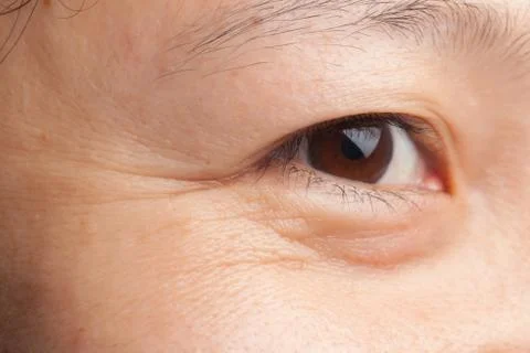 Eye wrinkle Foto stock