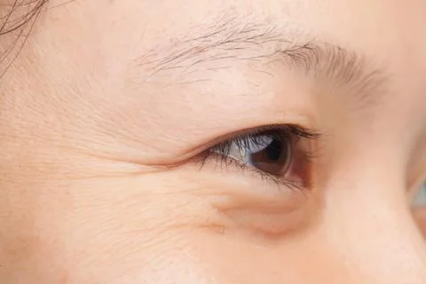 Eye wrinkles Foto stock