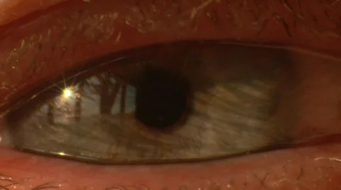 Eyeball 1 Stock Footage 649504