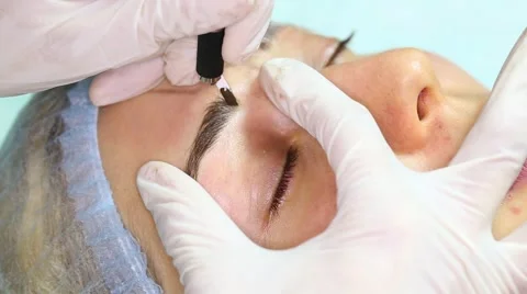 Eyebrow Mikrobleyding Stock Footage 65343492