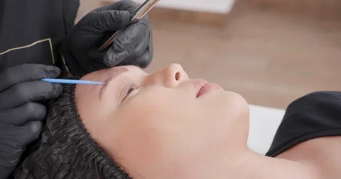 Eyebrow tatoo removal using a 3 point needle pen to extract the ink Stock Footage 103792423