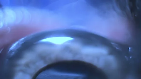 Eyes as a planet Stock Footage 59937800
