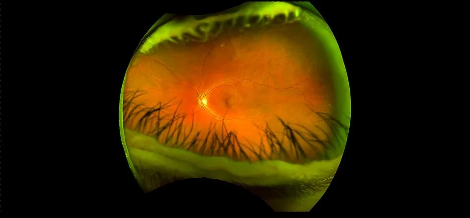 Eye's retinal angle image with macula, vessels and optic disc isolated view o Stock Photos