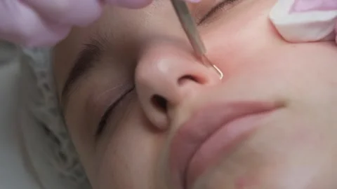 Face cleaning, skin care. Stock Footage 317367308