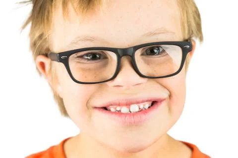 The Face of Downs Syndrome Stock Photos