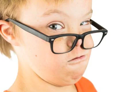 The Face of Downs Syndrome Stock Photos