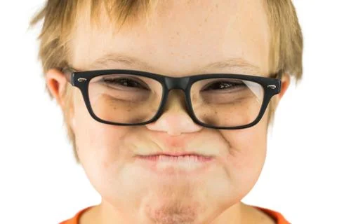 The Face of Downs Syndrome Stock Photos