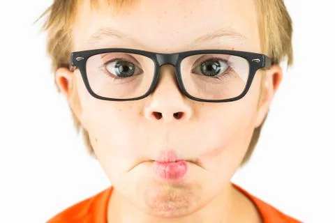 The Face of Downs Syndrome Stock Photos
