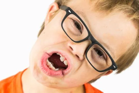 The Face of Downs Syndrome Stock Photos
