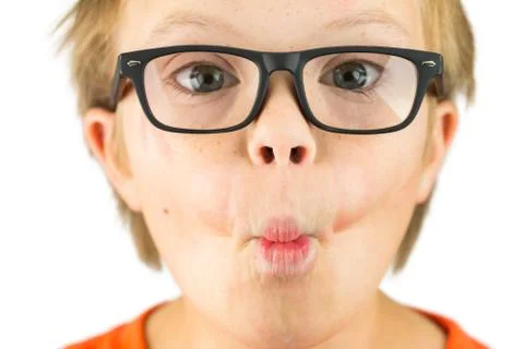 The Face of Downs Syndrome Stock Photos