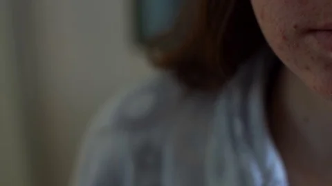 Face of girl with acne problem, close-up Stock Footage 73687909