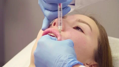 Face of patient during lip augmentation Video stock 84674841