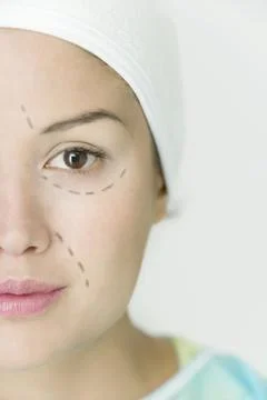 Face plastic surgery Stock Photos