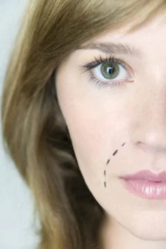 Face plastic surgery Stock Photos