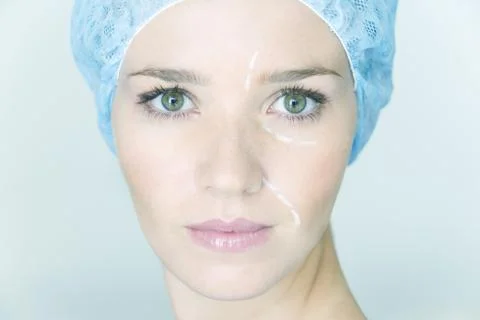 Face plastic surgery Foto stock
