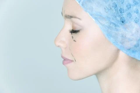 Face plastic surgery Stock Photos