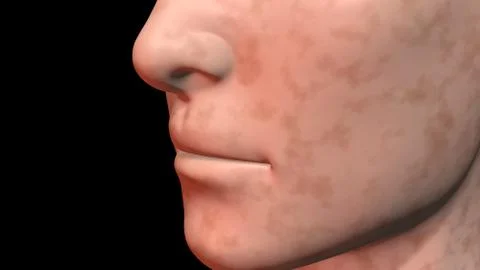 Face skin age spots medium surface color. 3d rendering Stock Illustration