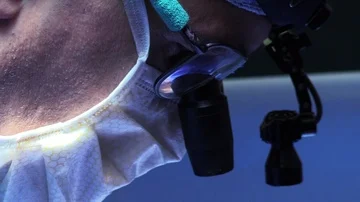 Face of the surgeon in operation Stock Footage 85940659