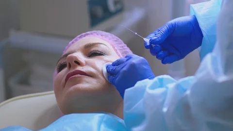 Face thread lifting procedure Stock Footage 116238029