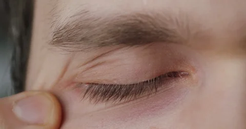 Face touch - coronavirus concept. Man touching his eye.  COVID-19 risk Stock-Footage 127376937