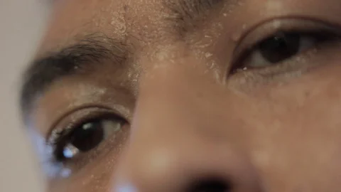 Face of very sweating Stock Footage 77061222
