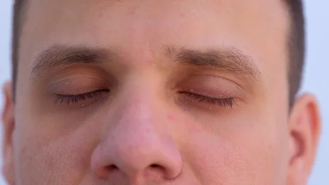 Face of young man on light background with small papillomas on eyelids. Video stock 123337017