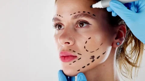 Facial Aesthetics Facelift. Plastic Surg... | Stock Video | Pond5