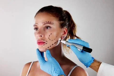 Facial Aesthetics Facelift. Plastic Surgery Drawings Stock Photos