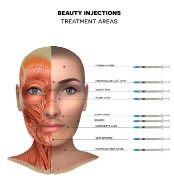 Facial injections Illustrazione stock