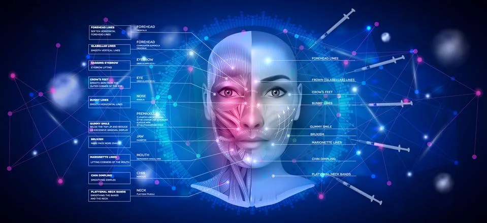 Facial injections Stock Illustration