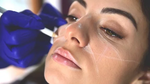 Facial lifting effect on skin Stock-Footage 106555702