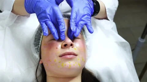 Facial massage with a special solution called biorepeel, the procedure is in a Stock Footage 278100482