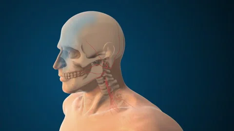 Facial Muscle Weakness Caused by Cranial Nerve Damage Stock Footage 328702542