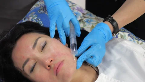 Facial ozone therapy: cosmetologist performs injection procedure in a clinic Vidéo 301792328